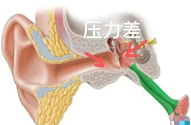 耳朵灌水了一直闷聋怎么办