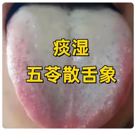 男生肾虚怎么补