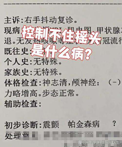 不知不觉的摇头是怎么回事