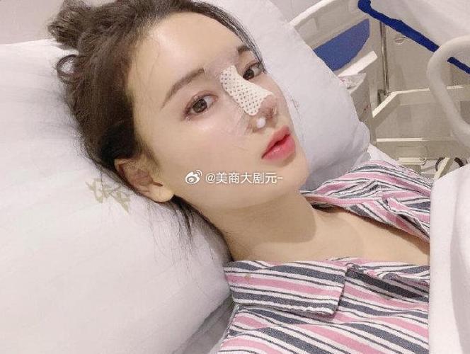 做肋骨鼻取肋骨的地方多久恢复图标