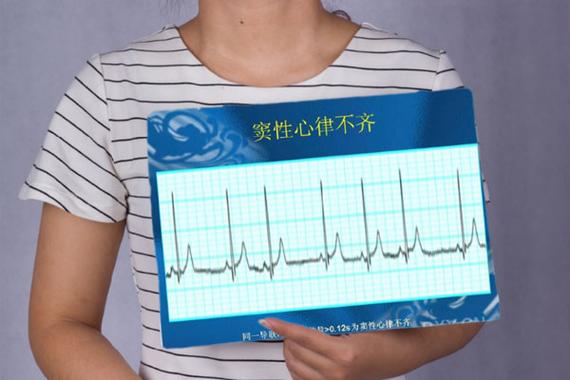 心律不齐一般寿命多长