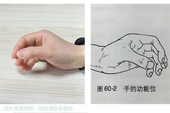 手功能康复13个动作