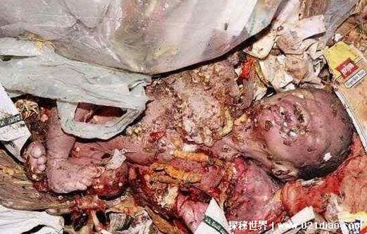 婴儿尸骨放袋子里能腐烂吗