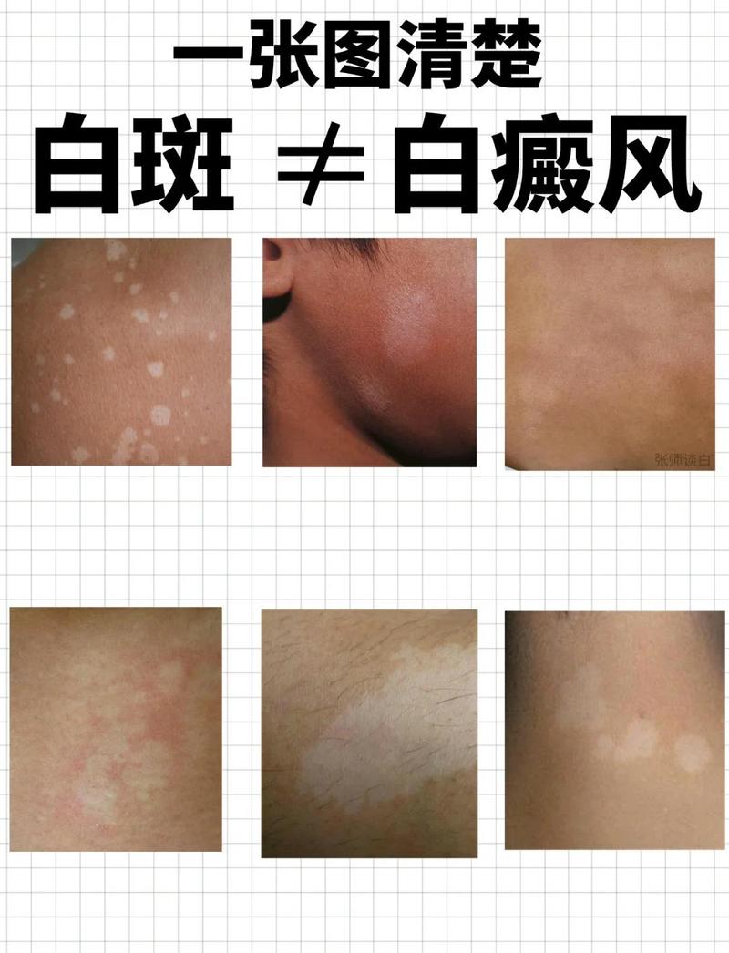 oppo手机有个白色圆点是什么