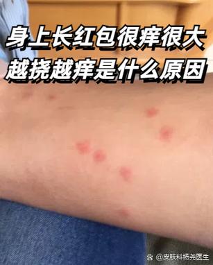 脸上长两个红包痒