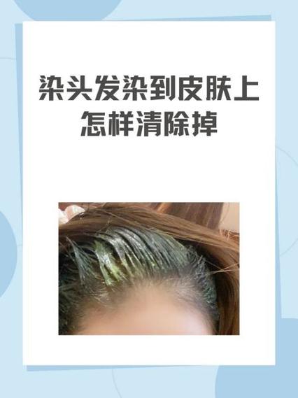 染发失败怎么去掉颜色