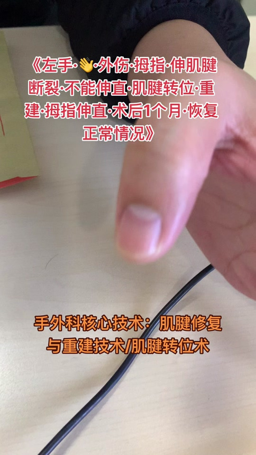 大拇指康复训练视频
