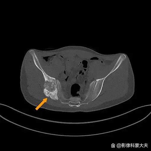 骨科男主是妹控截图