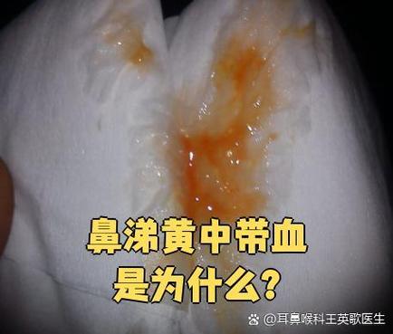 大量黄鼻涕带血