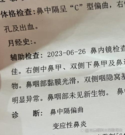 流鼻血到医院检查要多少钱