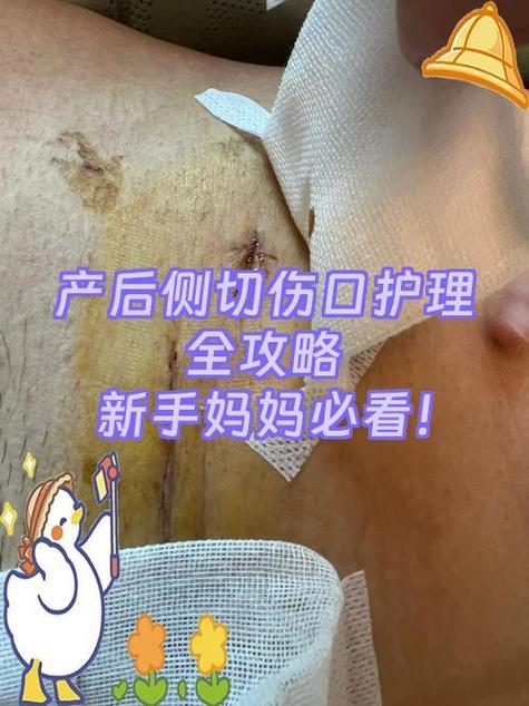 内缝线头出来了怎么办截图