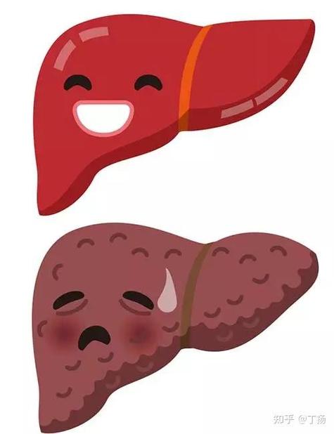 脂肪肝能吃鸡蛋吗