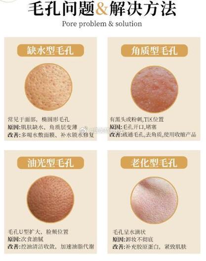 如何让脸上毛孔缩小