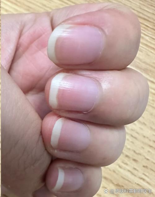男生涂黑指甲油是0吗