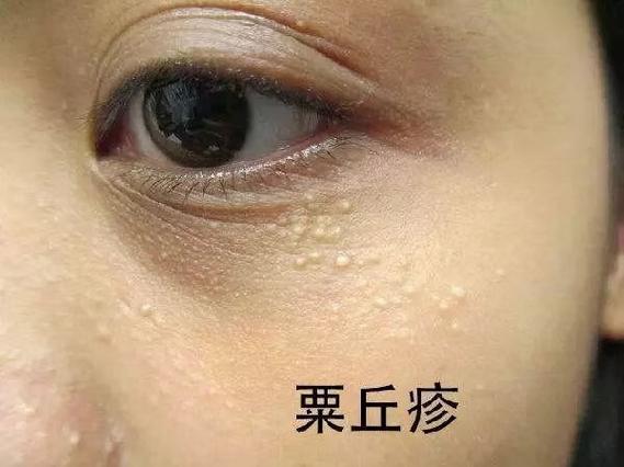 小疙瘩阅读网