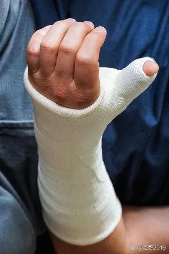 手腕骨折一般赔几万