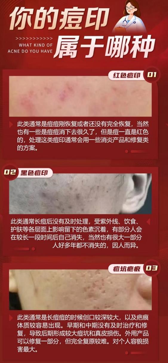 红色痘印淡化过程是怎样的