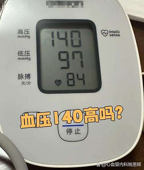 男人血压140高吗