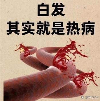 白头发焗油还是染发好