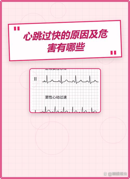 心率过快会有什么危险