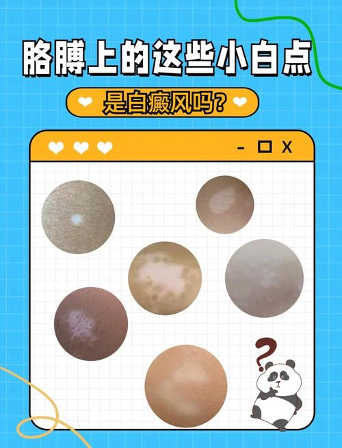 手机屏幕出现白斑的原因