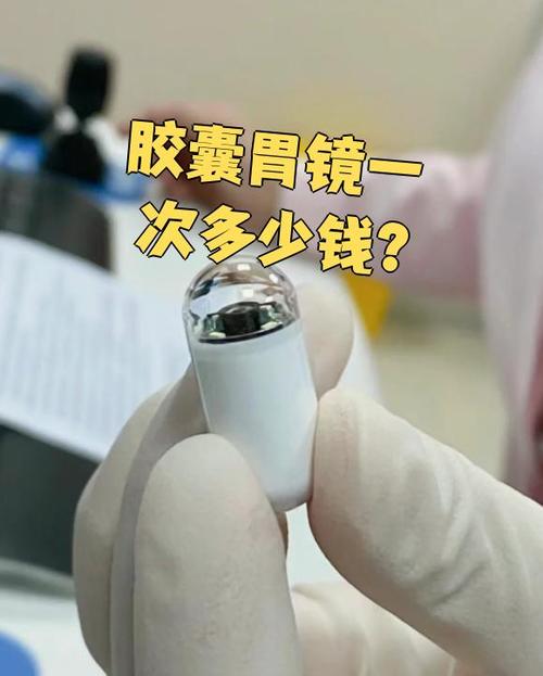 做一次胃镜大概需要多少钱缩略图
