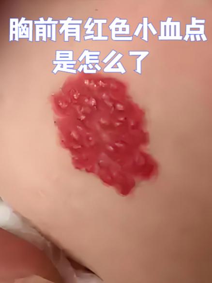 手机上方有个红色的小点一直闪缩略图