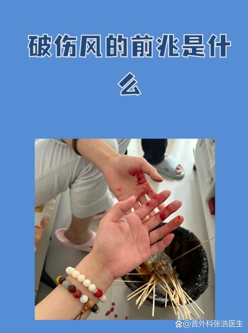 一天打破两样东西预兆