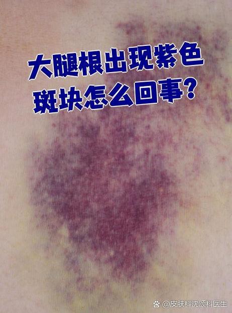 屏幕黑色有紫斑