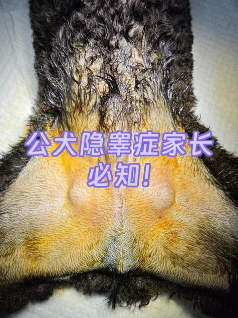 睾丸长毛怎么除掉图标