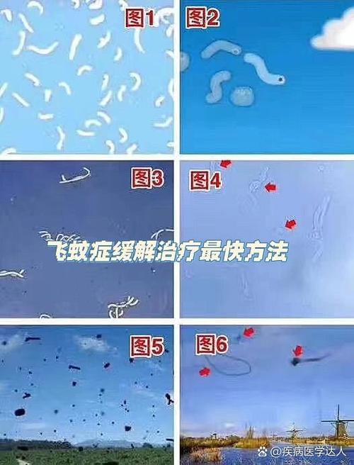 飞蚊症能治好吗?