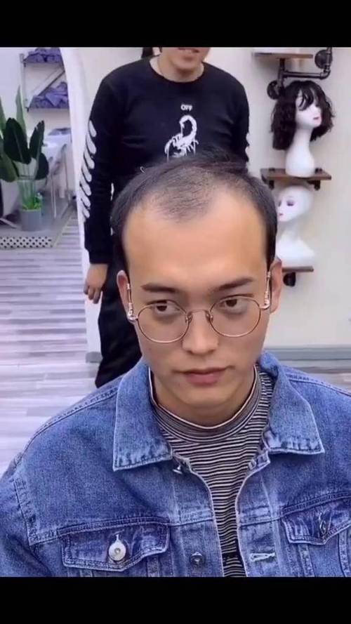 男士脱发理什么发型