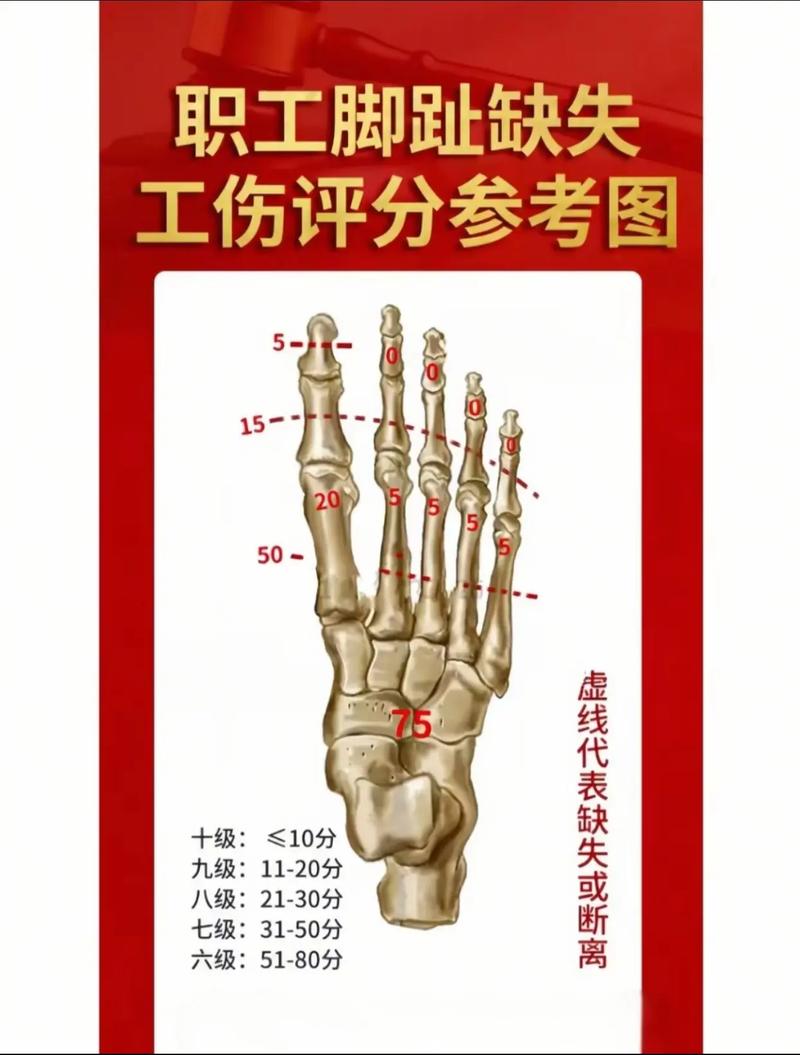 脚趾头骨折是几级伤残