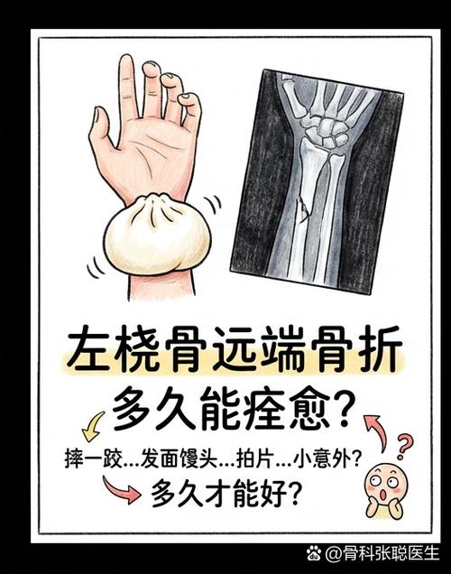 手腕摔伤多久能好