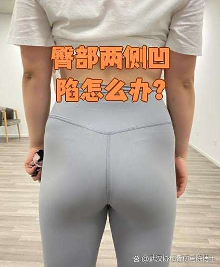 臀部两侧凹陷怎么改善