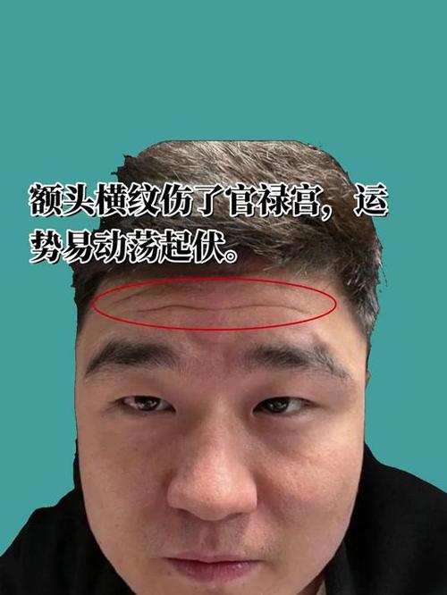 额头有横纹是怎么回事
