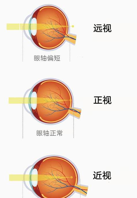 远程看护摄像头
