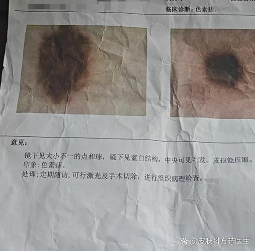 打印纸上有黑点是怎么回事缩略图
