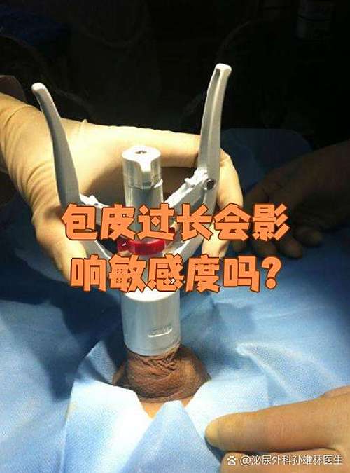 正常情况下龟露着还是包着
