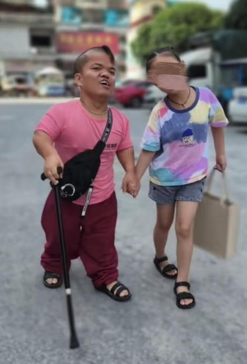 侏儒又叫什么人