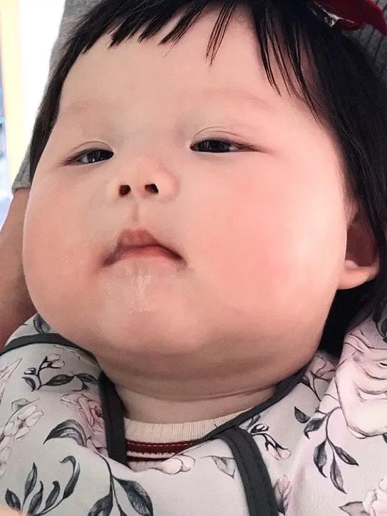 脸上能捏起一团肉是脸胖吗