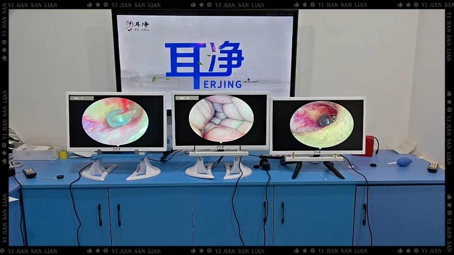 高清可视采耳设备