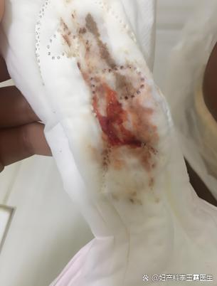 以前月经很少这次突然多了