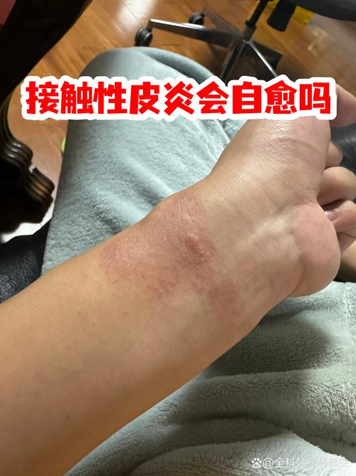 游戏皮肤获取的限制条件