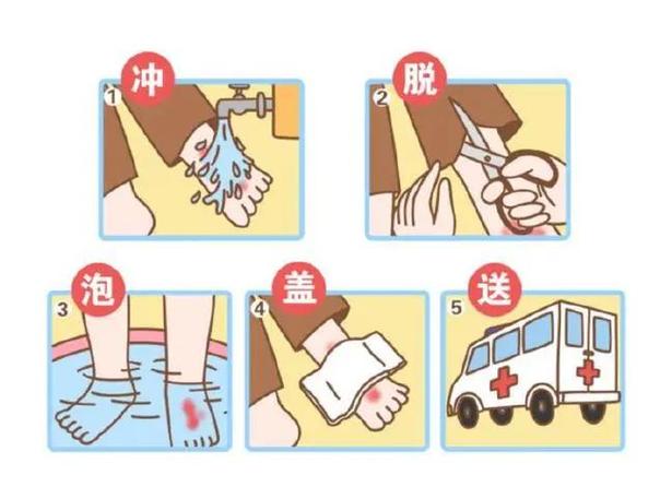 烫伤后该捂着还是晾着