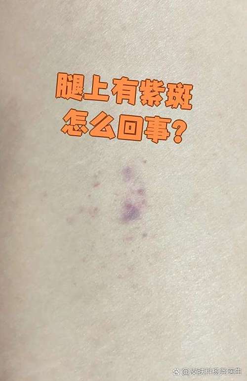 手机屏水墨一样紫斑