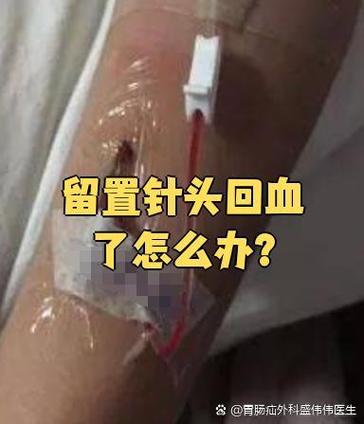 什么叫回血