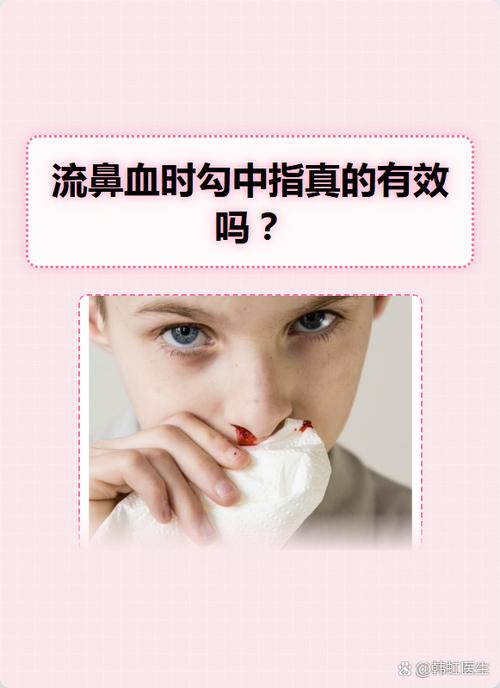 小孩流鼻血民间土方