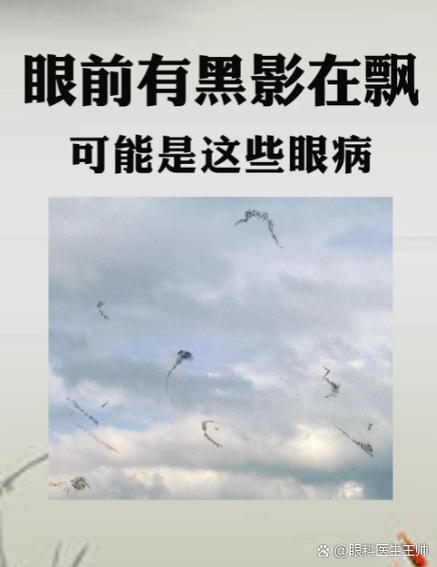 看到黑影子有什么影响吗