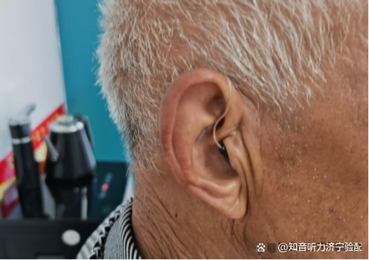助听器戴久了耳朵会不会越来越严重